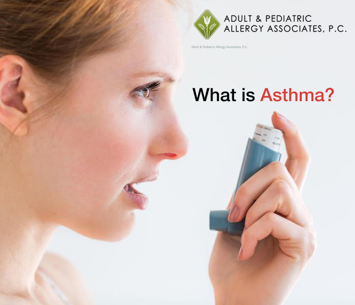 Asthma Allergy 